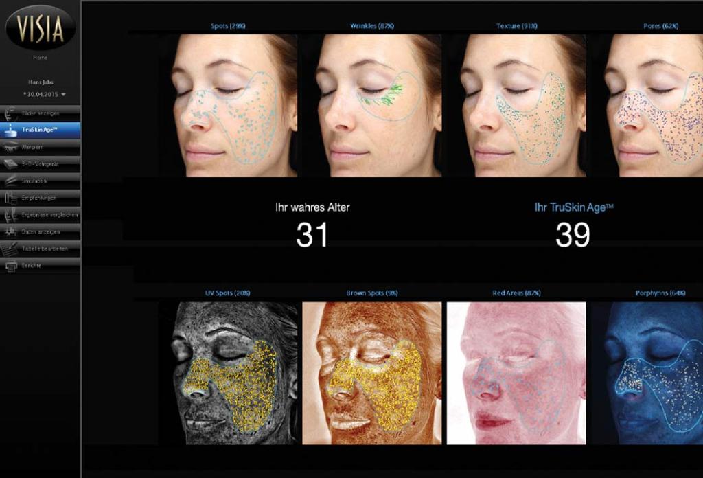VISIA TruSkin Age Hautanalyse Auswertung – Pure Skin Helmstedt