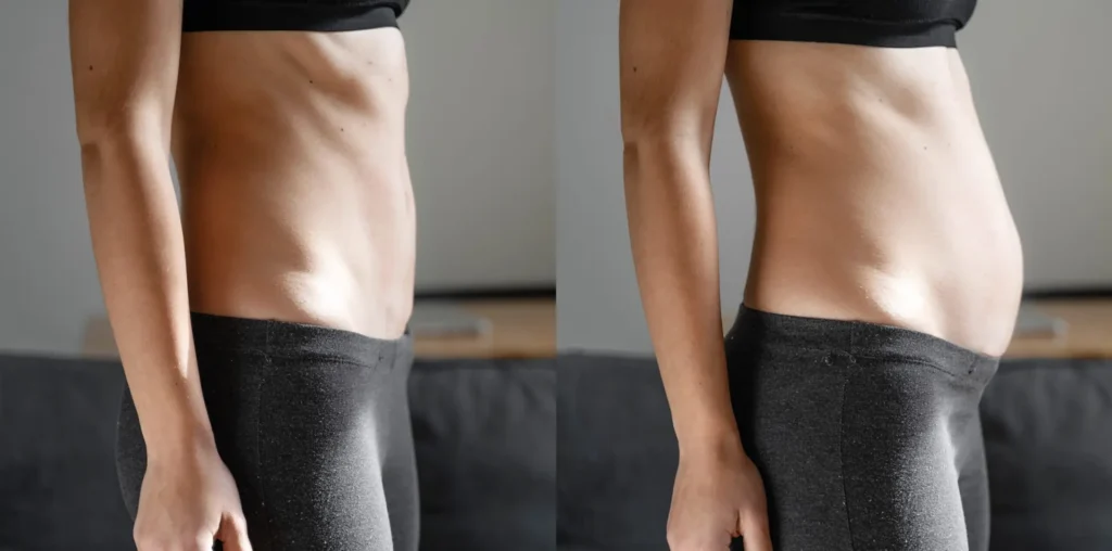 Darmgesundheit Hautprobleme Vorher Nachher – Pure Skin Helmstedt