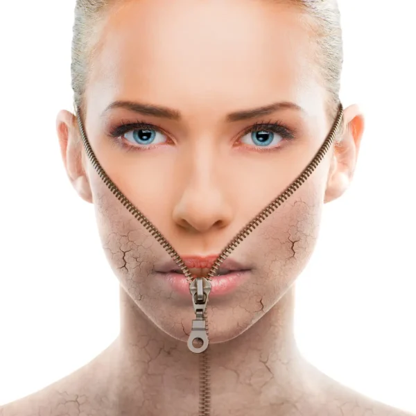 SkinPen Precision Microneedling Ergebnis – Pure Skin Helmstedt