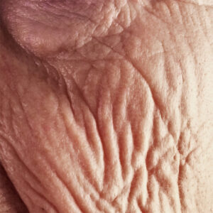 Falten Behandlung Helmstedt – Pure Skin Kosmetikinstitut