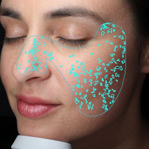 ISIA Fleckenanalyse – Hautanalyse Pure Skin Helmstedt