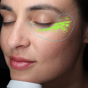 VISIA Faltenanalyse – Hautanalyse Pure Skin Helmstedt